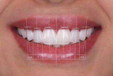 کامپوزیت